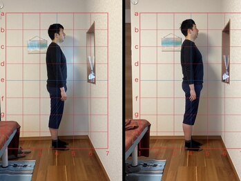 アロハ(ALOHA)/整体/肩こり/姿勢改善/白楽