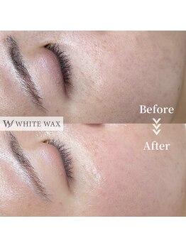 ホワイトワックス 浜松(WHITE WAX)/ふさふさ肌から艶肌へ★