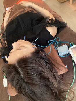 ハリファ鍼灸院 横浜関内院(HariFa鍼灸院)/美容鍼施術/美容鍼