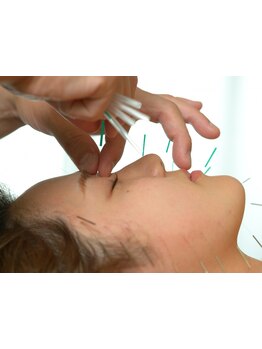 ホウレイ線・たるみ改善！予防ケア