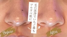 エクラ アン(eclat.un)