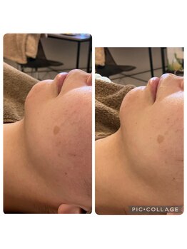 サロン ド レア(Salon de Lea)/様々なお悩みに対応!