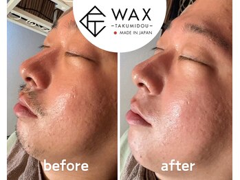 シエルエトワール 唐津店(Ciel Etoile)/匠道メンズヒゲ×フェイシャル