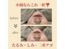 プリア 今治店(Pria)の雰囲気（「小顔」「二重アゴ」スッキリ&キュッと★）