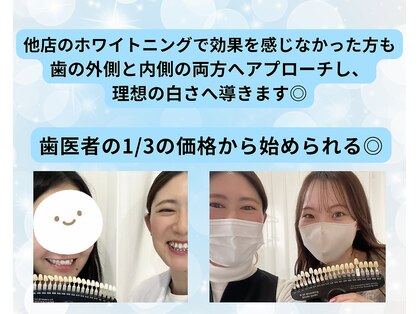 ホワイトニングビューティー 行橋店の写真