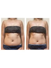 ピエリ ザ ビューティステイション 春日原店(Pierie THE BEAUTY STATION)/お腹周りスッキリ♪