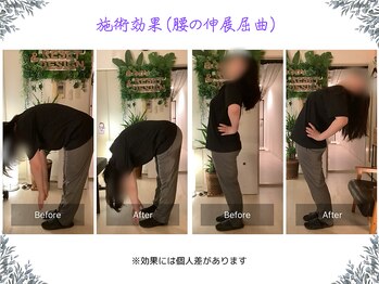 ボディ リセット アンド デザイン(Body Reset & Design)/【施術例】ビフォーアフター