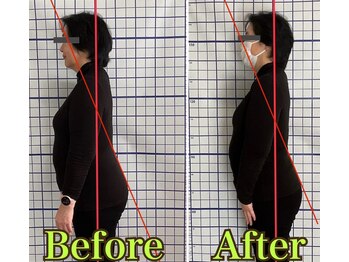 幸鍼灸整体院 武庫之荘院/整体・トレーニング・姿勢変化1