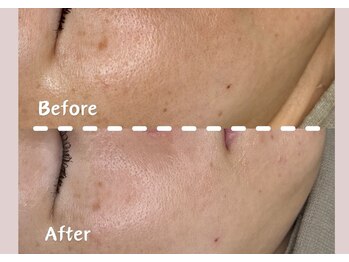 シー センター北(sii)/ハリと弾力、Wで実感！