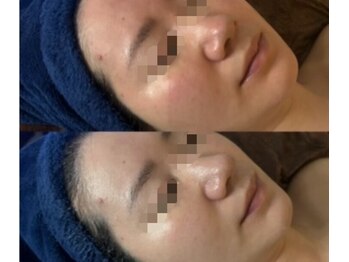 オーシャンブルーム 目黒(OceanBloom)/アンストレス/乾燥