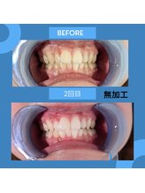 ビューティーラボ(Beauty Lab.)/