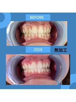 ビューティーラボ(Beauty Lab.)/