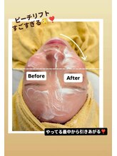 クレール 小山店(CLAIR)/【リフトアップ・小顔】