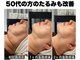 リシェ 市川(riche)の写真/納得の技術に遠方から通う方多数!!最速で小顔&美肌を実感できる[小顔矯正+リフトアップ施術+筋膜リリース]