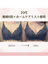 ミミバスト(mimibust)/バストアップBeforeAfter
