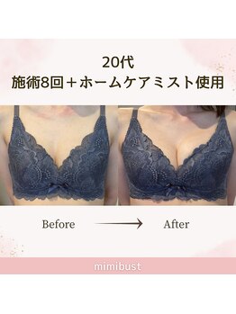 ミミバスト(mimibust)/バストアップBeforeAfter