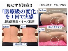クリニカルエステ イーズ 三宮店の雰囲気（信頼のおけるスタッフと自分に何が合うかじっくりカウンセリング）