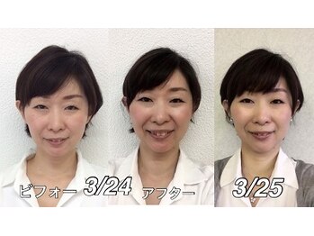 ビューティスタジオＫ/小顔矯正ビフォーアフター