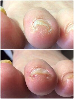 モアクリスタル(More Crystal)/