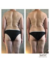 サプナジー(Suppnrgy)/カスタムトリートメント