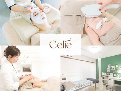 セリー(Celie)の写真