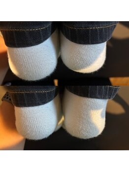 アッド整体院/骨盤の歪み