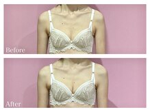 ククナ(KUKUNA)/*バストアップマッサージ*