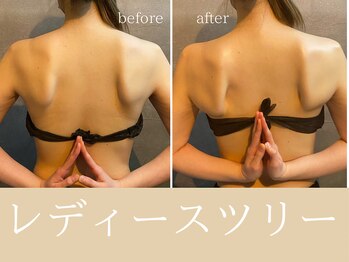 チャームズ(CHARM'S)/レディースツリーセラピー★