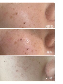 メディカルエース(MedicalAce)/スポット