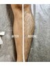 【脚オール】男性 ワックス×光　W脱毛19,980円