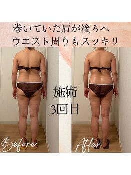 ラルーエ 仙台/全身筋膜痩身90分before→after