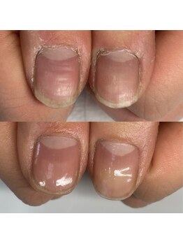 シャドウ(shadow)/ごっつい甘皮もこの通り