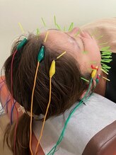 ハリスル 神戸訪問鍼灸付属治療院(harisuru)/顎・首・鎖骨ライン特化美容鍼