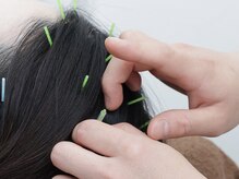 スプリング鍼灸院(Spring鍼灸院)/中々、寝付けない。そんな時は！