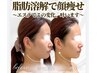【平日限定★10:30~15:00 】人気No.1◎"脂肪燃解"2ml 28,600円→22,000円