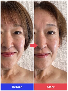 ローズジャスミン(RoseJasmine)/リリースカッター小顔