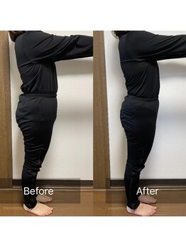 ヨサパーク リン(YOSA PARK Rin)/美bodyプレミアムコース20回