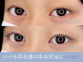 アイラッシュサロン ブラン 大分駅前店(Eyelash Salon Blanc)/まつ毛パーマ・ビフォーアフター