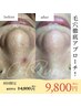 【毛穴ケア】黒ずみ/凸凹/開きに毛穴つるぴかエステ￥14,800→￥9,800