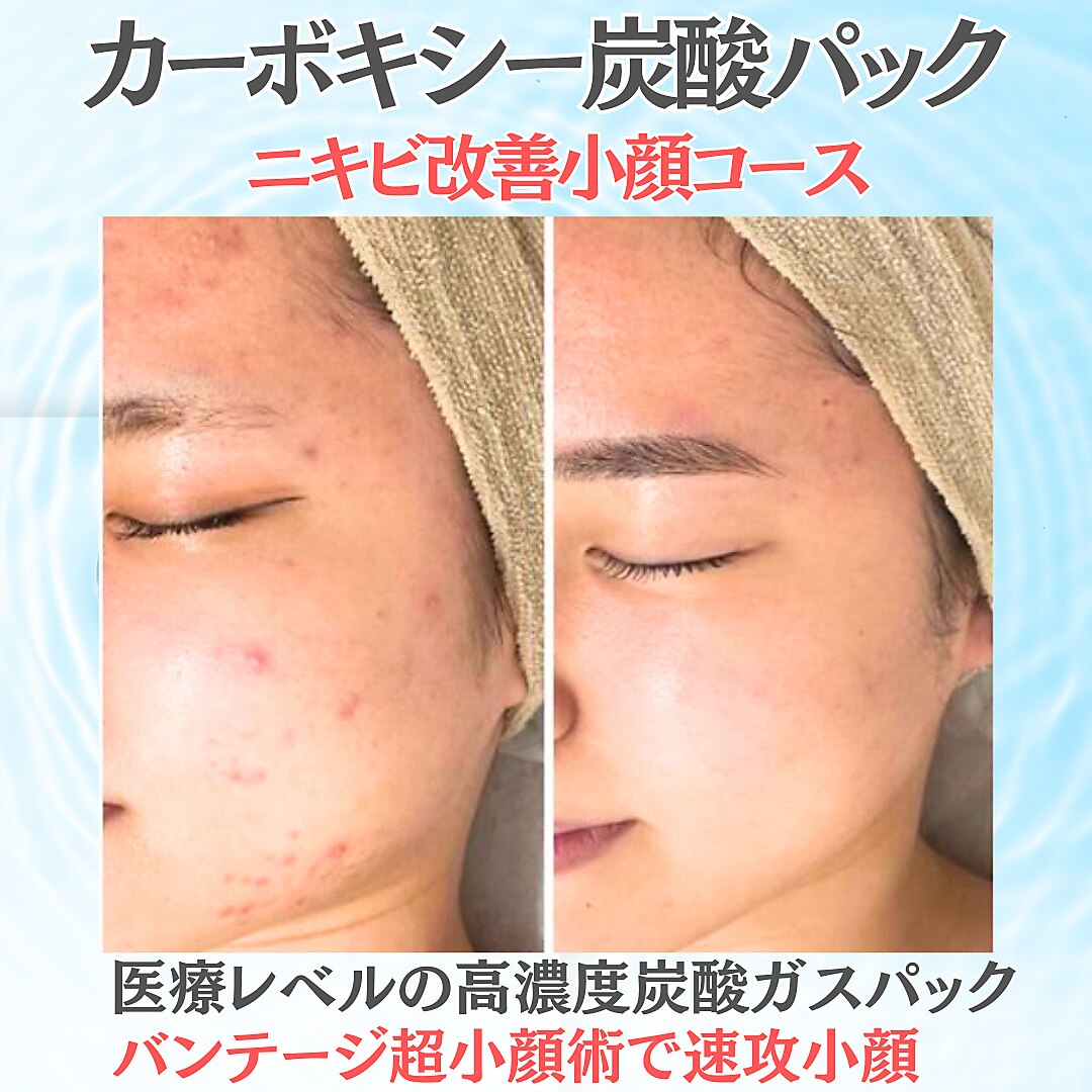 キレナル(KIRENAL)｜ホットペッパービューティー