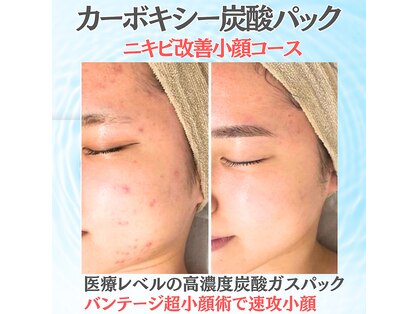 キレナル(KIRENAL)の写真