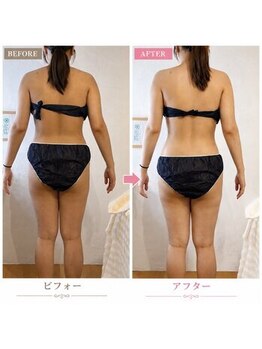 ポノサロン(pono salon)の写真/ワンサイズ下の服を着たい！夢は叶う◎くびれを手に入れて最強女子爆誕◎年齢を重ねて代謝が気になる方も！