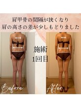 ラルーエ 仙台/全身筋膜痩身90分before→after