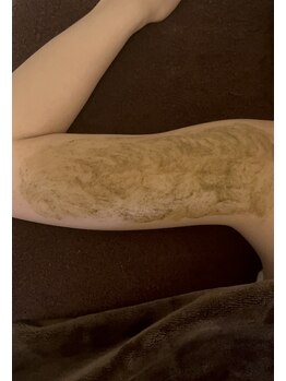 アイル(iru)/ボディハーブピーリング