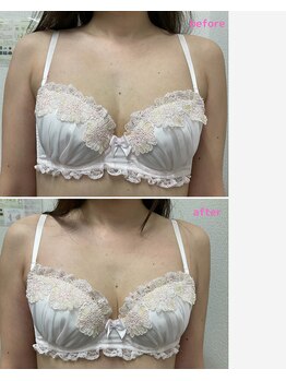 バーディー(BIRDIE)/施術1回/30代