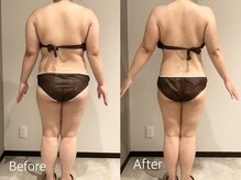 エステティック ミュー(Esthetic MiEUX)/全身痩せコース途中経過