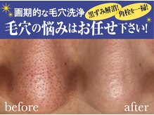 ファニービー 茨木店/１回の施術のビフォーアフター