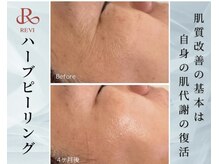 ルッカヘアガーデンバイラッシュゴールド(RUCCA HAIR GARDEN by LUSH GOLD)/REVIハーブピーリング