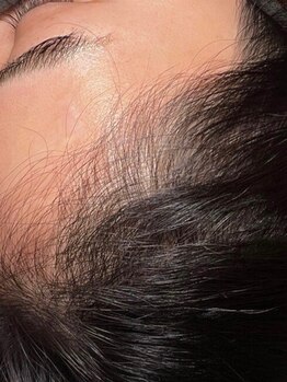 武蔵小山店の写真/結果にこだわりたい方に。最新技術で健康的な髪へ◎なりたいヘアスタイルを自由自在に[育毛促進]