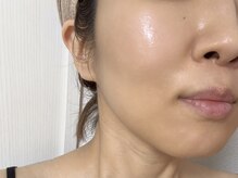 ヴィーダ 渋谷松濤(ViDA)/スキングロウマスク